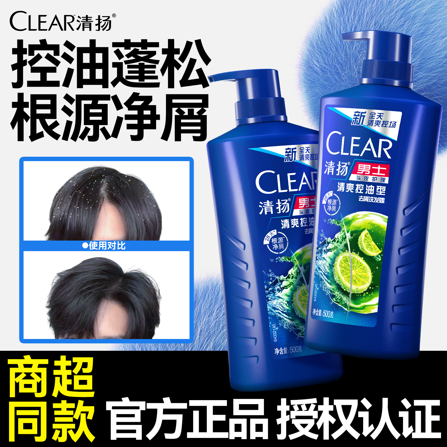 【热卖榜单】控油蓬松去屑洗发水