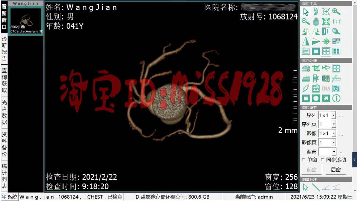CT工作站软件CT报告软件DR工作站软件CR工作站软件MRI核磁软件