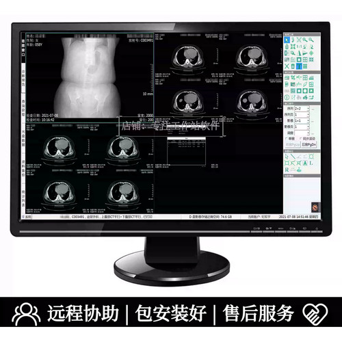 放射科CT软件DR软件CR软件数字胃肠机软件DSA软件MRI软件PACS系统