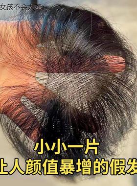 假发片头顶短发无痕轻薄真发遮白自然网红女生头顶部逼真贴LHAL4