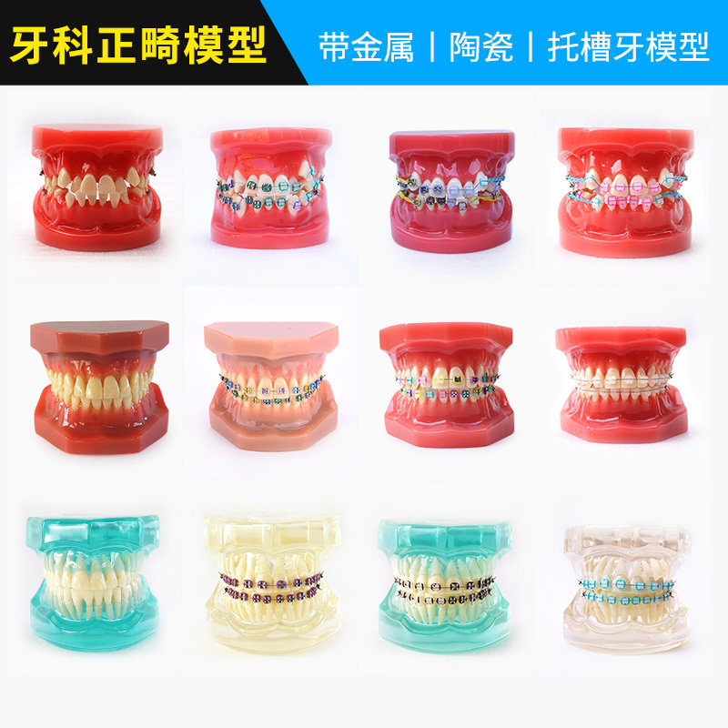 牙科齿科正畸模型型号齐全金属托槽半金属半托槽全陶瓷标准牙模型