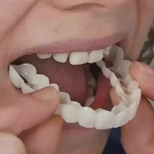 牙套吃饭神器通用临时遮丑美白贴片缺牙老人全口义齿假牙塞牙牙缝