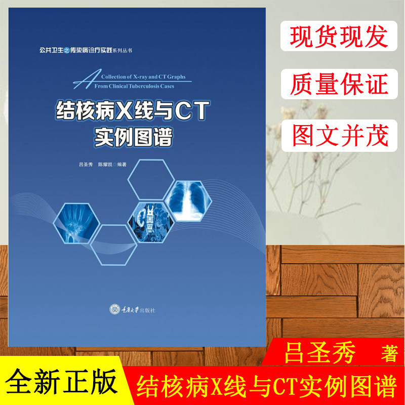 正版现货 结核病X线与CT实例图谱 吕圣秀,陈 生活 影像学 影像医学 重庆大学出版社
