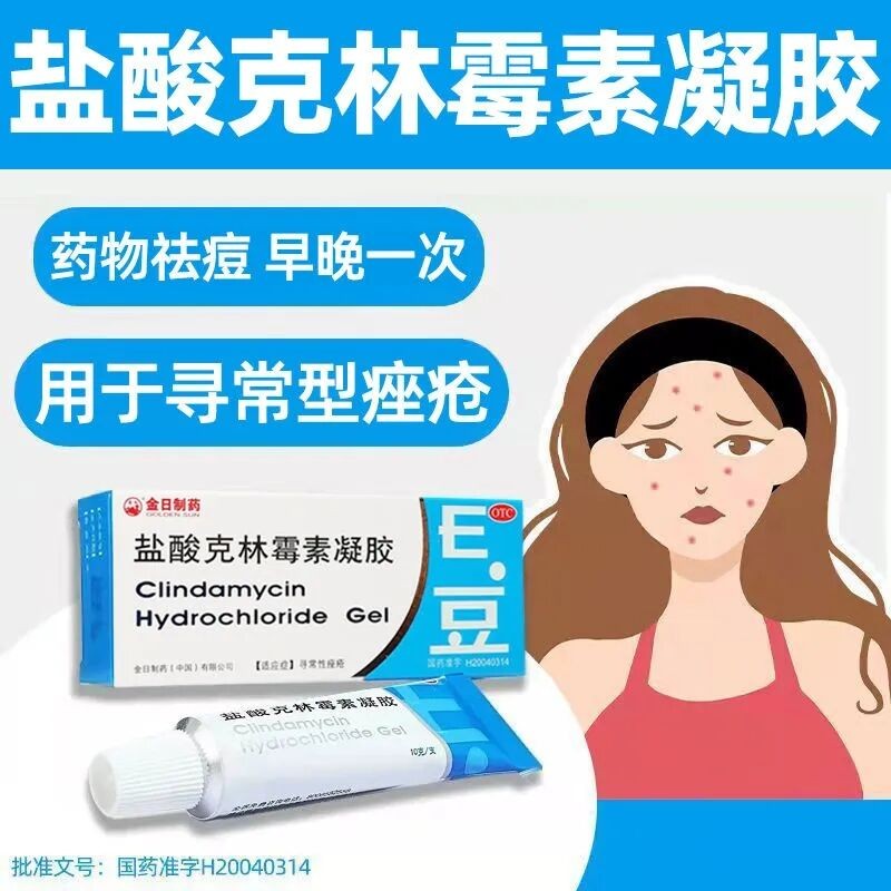 金日盐酸克林霉素凝胶10g去痤疮粉刺黑头祛痘e豆青春痘暗疮软膏20