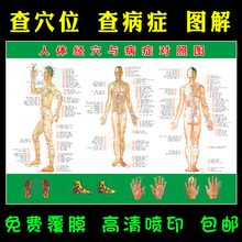 中医馆艾灸按摩针灸全身穴位挂画 人体经穴位与病症对照图高清版