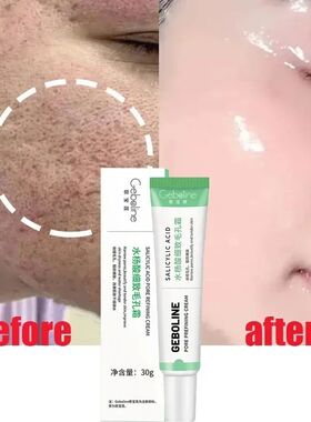 Salicylic Acid Pore Shrinking Cream Quick Remove Blackehead