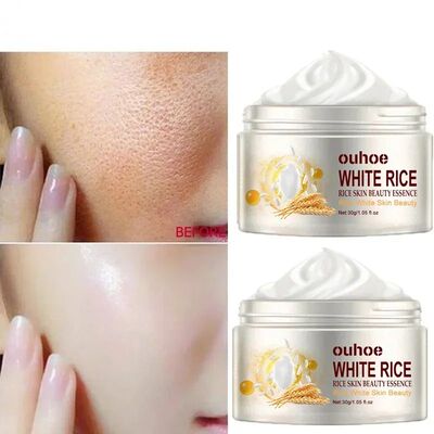 White Rice Face Whitening Cream Remove Dark Spots Fade Freck