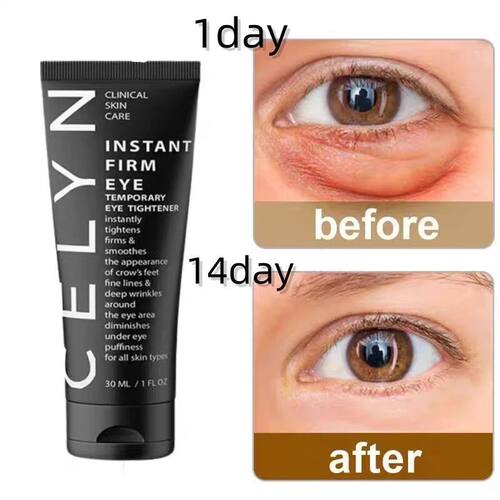 Eye Tightening Cream Anti Dark Circle Moisture Serum Puffy E