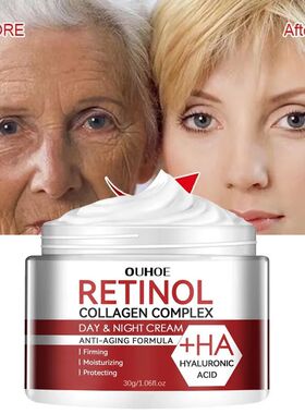 Retinol Wrinkle Removing Cream Anti Aging Firming Lifting