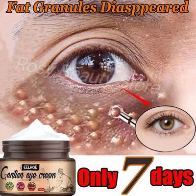 Fat Granules Remover Eye Cream Remove Dark Circles Eye Bags