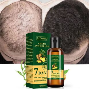 1pcs Ginger Hair Growth Products Anti Hair Loss Serum