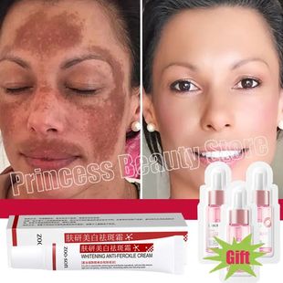 Whiten Cream Brighten Powerful Fast removing Skin Elimi Spot