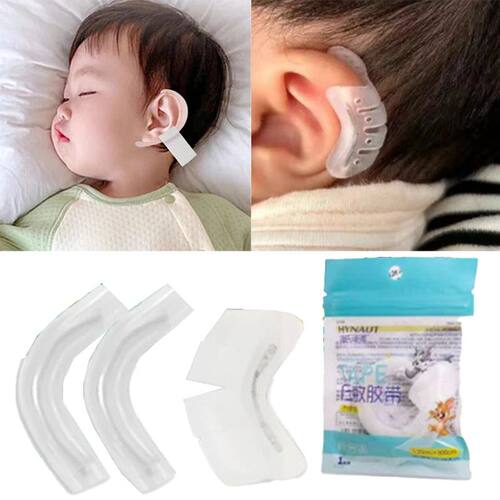 Protruding Ear Support Infant Corrector Tools Silicone Auric