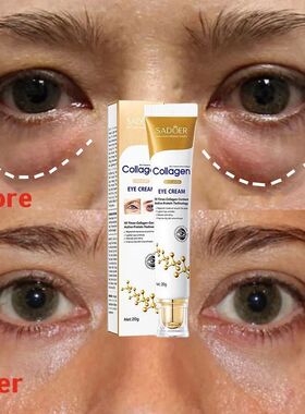 Instant Eye Bag Removal Cream Removal Wrinkles Firming Skin