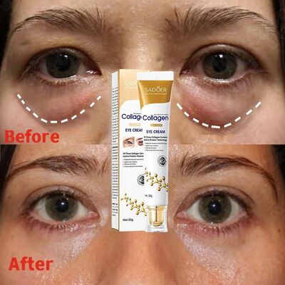 Instant Eye Bag Removal Cream Removal Wrinkles Firming Skin