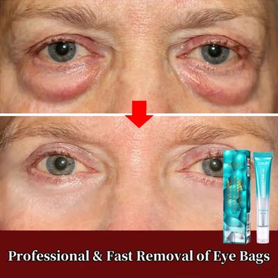 7 Days Reduce Fine Lines Eye Bag Cream Anti Wrinkle Remove P
