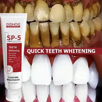 Whitening Teeth Caries Toothpaste SP 5 Gum Tooth Decay Repai