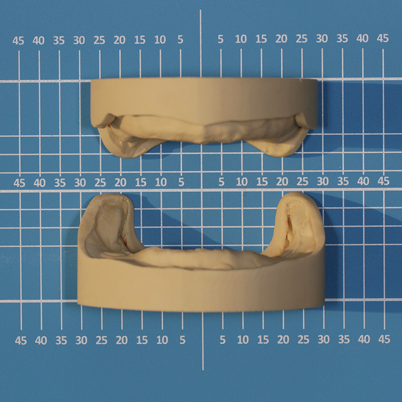 全口规格模型垫板雕牙图纸形态双面牙科口腔义齿吸附性技工送同款