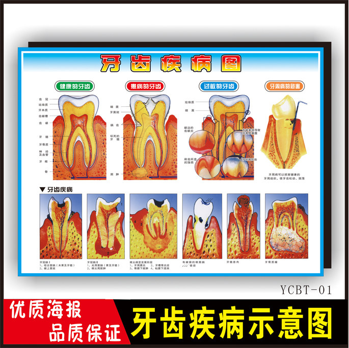 牙齿疾病图墙贴纸口腔知识贴纸牙科挂图宣传海报牙科知识宣传画