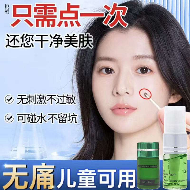 点痣去痣药水正品无痕去脸部痦子黑点美容院斑修复液不留疤旗舰店