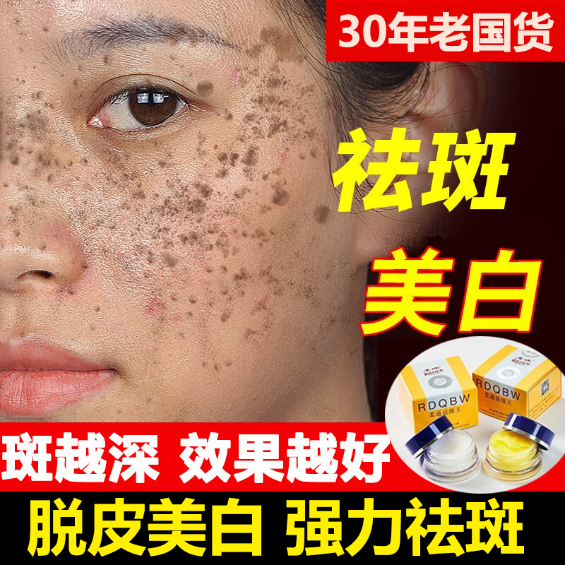 蜕皮美白祛斑霜第一名快速见效