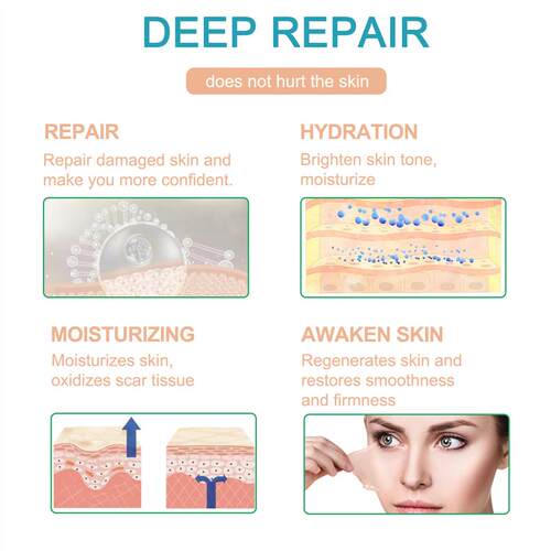 Medical Grade Silicone Scar Sheet Silicone Scar Tape 疤痕贴