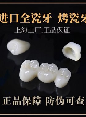 德国威兰德拉瓦二氧化锆全瓷牙烤瓷牙贴面假牙牙冠牙套进口烤瓷牙