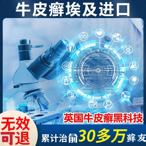 进口冶顽固顽固牛皮推荐皮肤护理牛皮癣专用进口美国配方埃及膏体