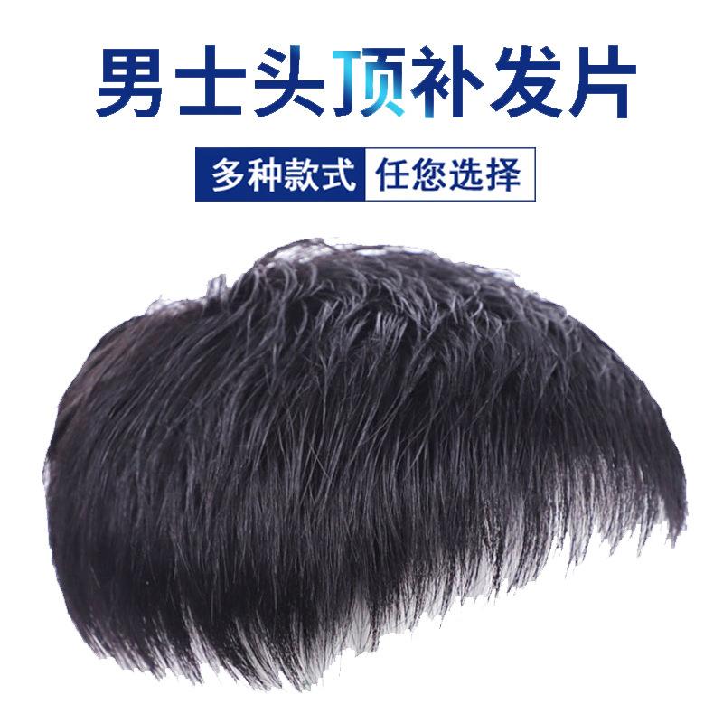 男士补发片假发套头顶补发前额秃顶补发垫接发翻盖假发真发男发块