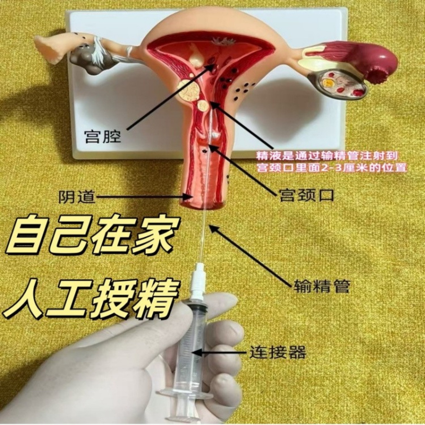 HH人工受精助孕器辅助用品