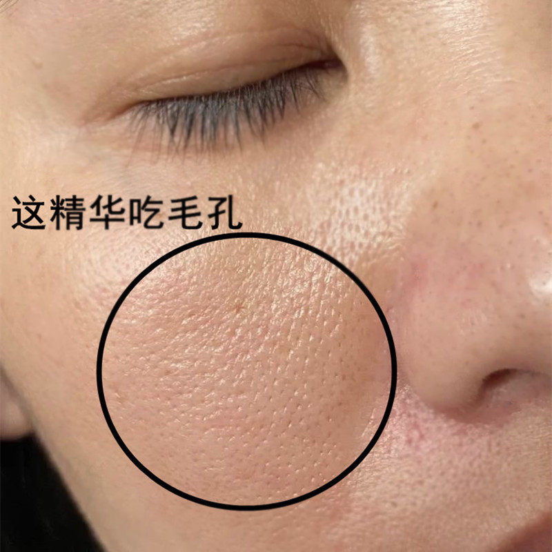 【第二瓶只需10元】乳糖酸收缩毛孔精华液 深吸黑头 水嫩肌肤