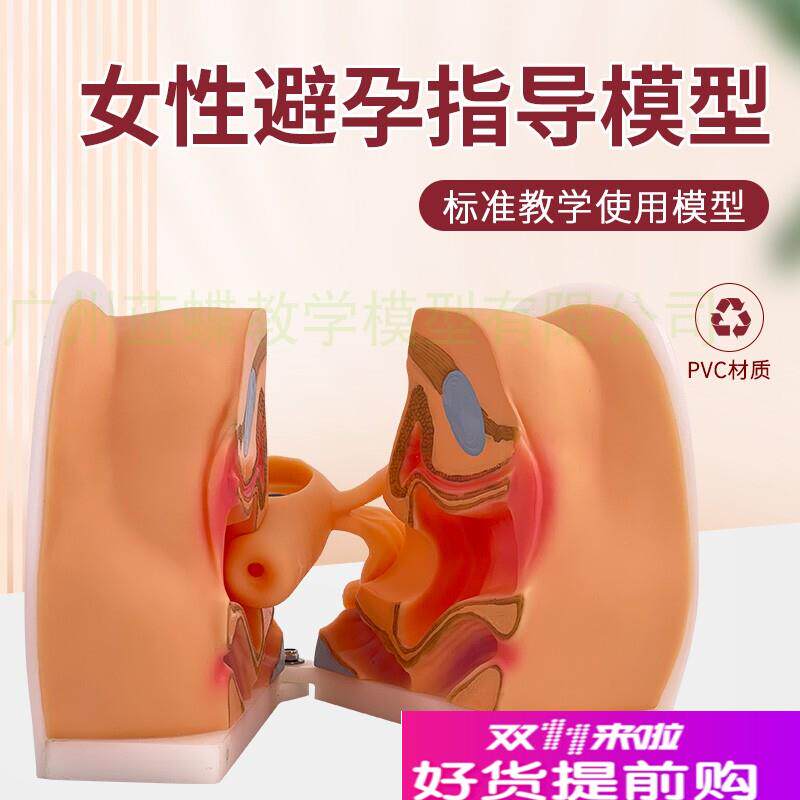 高级女性宫内避孕器模型妇女上环训练H指导节育计生教具子宫生殖