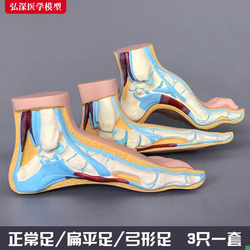 脚模型正常足扁平足弓型足解剖人体脚部构结构造肌V肉血管医学模