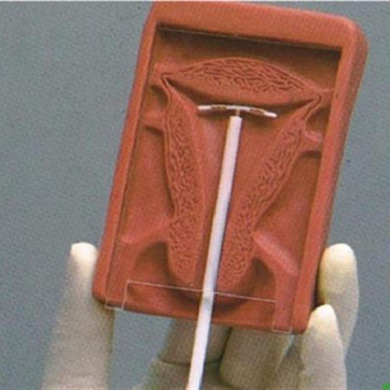 高级宫内避x孕器训练模型