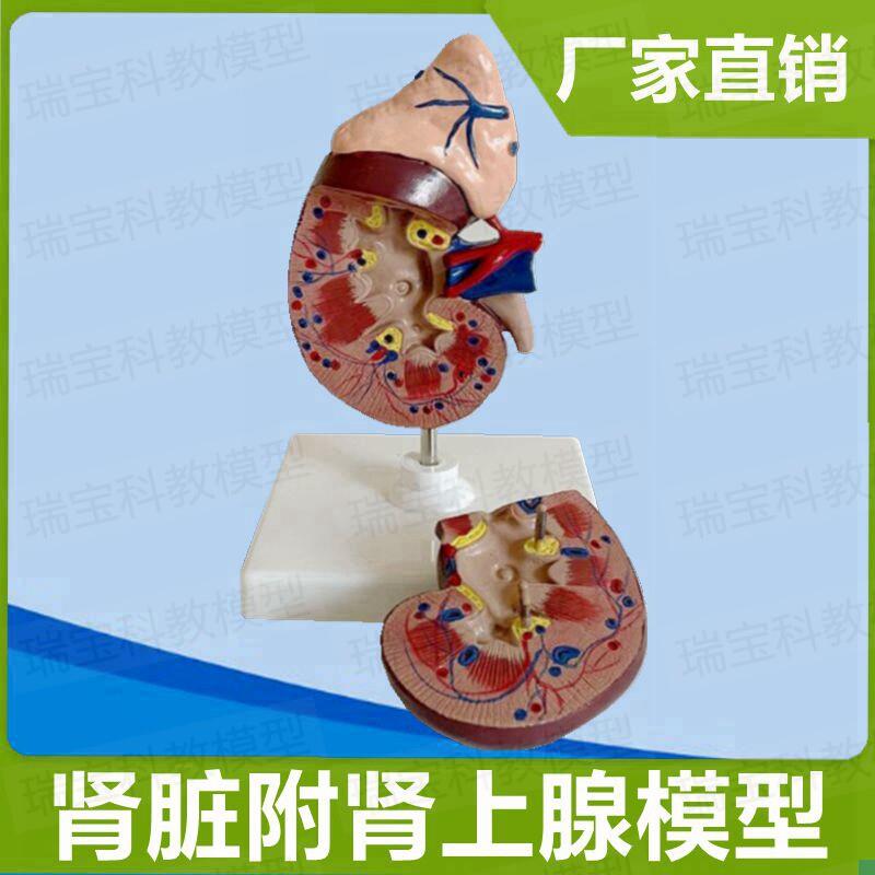 人体肾脏模型h自然大可拆卸带肾上腺泌尿系统外科肾结构输尿管