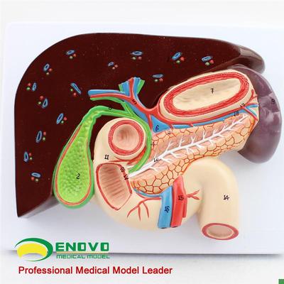 颐诺人体肝胆胰十二指肠胃结构模型消化I科医用Whipple模型