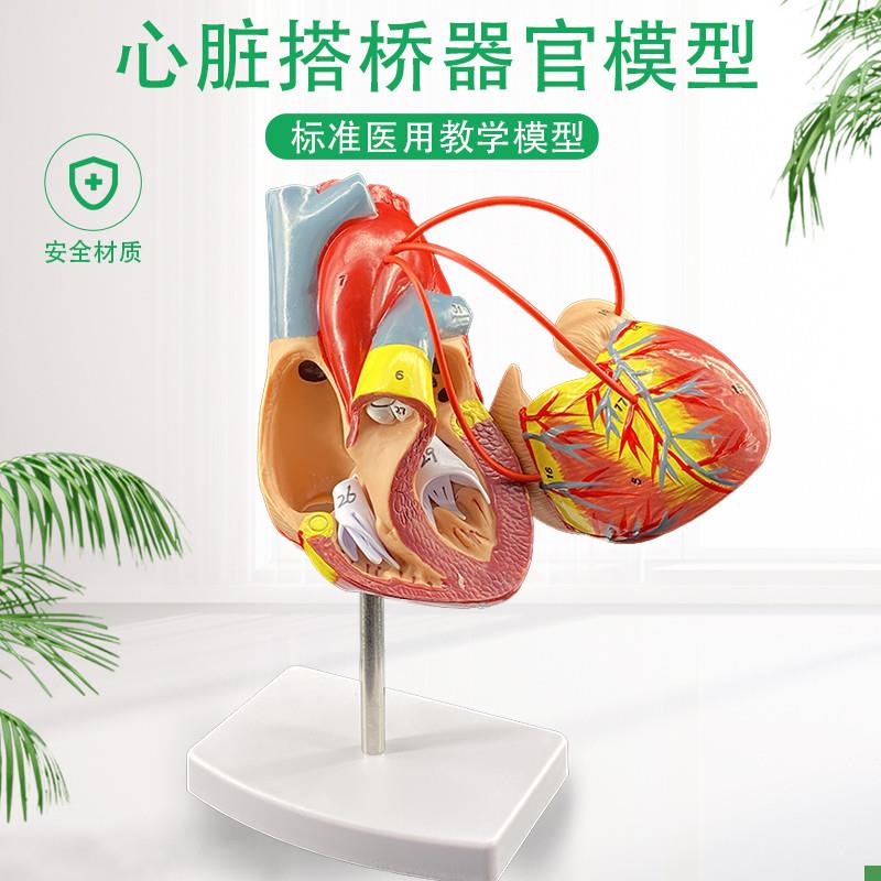 心脏搭桥模型人体器官结构层次解剖模型内脏医院学校教l学演示模
