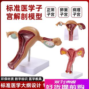 人体子宫卵巢附件女性生殖器阴道病D理变结构解剖模型医学教学模