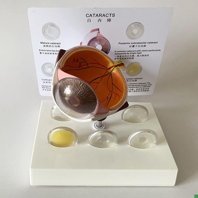 白内障眼b睛模型晶片虹膜器官解剖光学教仪医用医学教学教具包邮