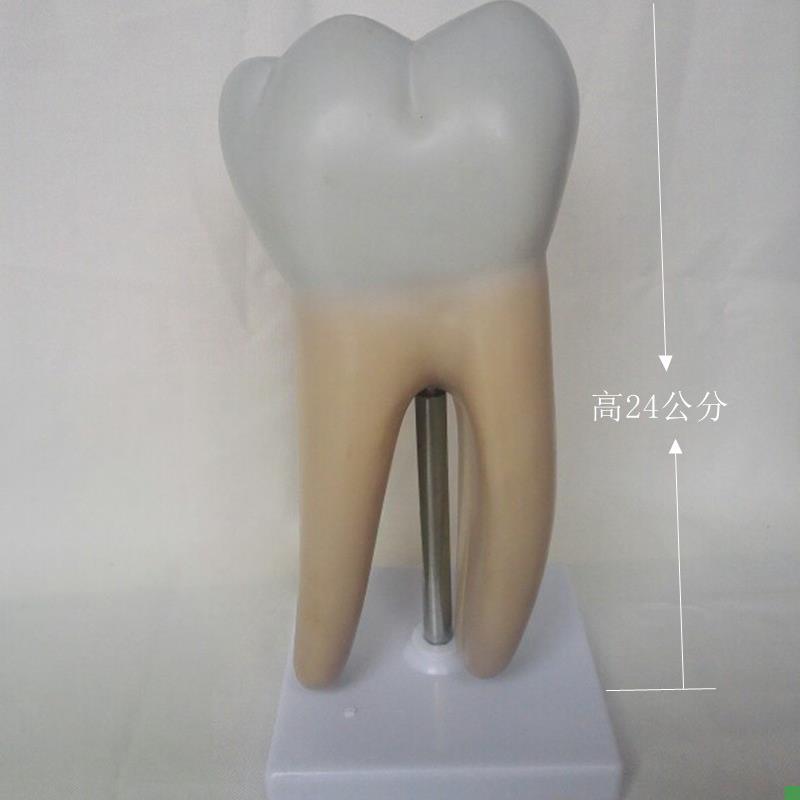 人体蛀牙解剖模型牙齿v牙科口腔展示医用教学讲解教具