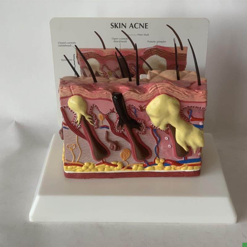 人体皮肤放大f皮肤痤疮毛发生长头发健康皮肤脱发毛囊毛细血管黑