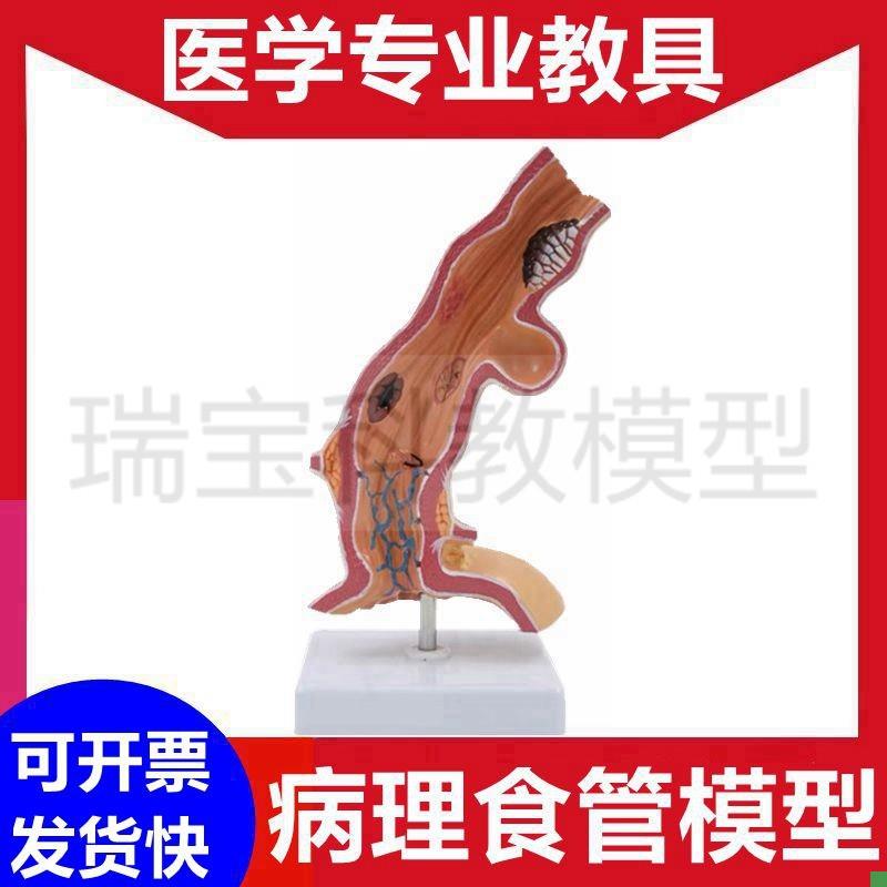 食管模型消化系统胃结构病理黏膜胃壁血I管神经胃镜教学医患沟通
