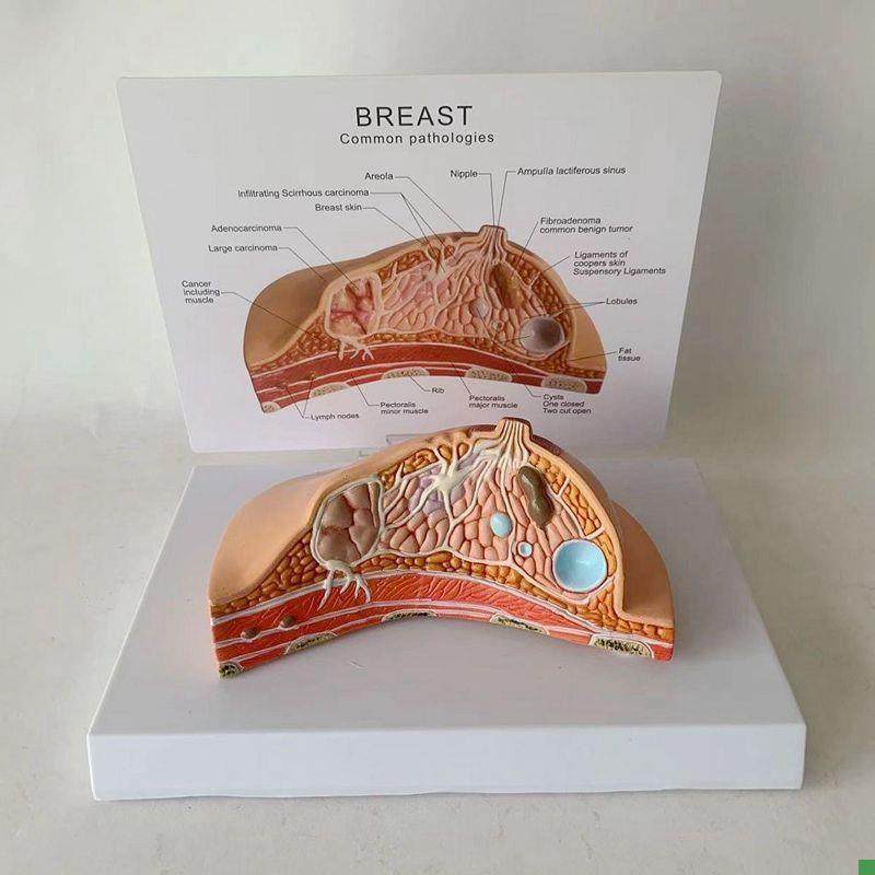 康泰医学乳腺模型病理乳房解剖女性生殖医药促销跨境直Z播热卖爆