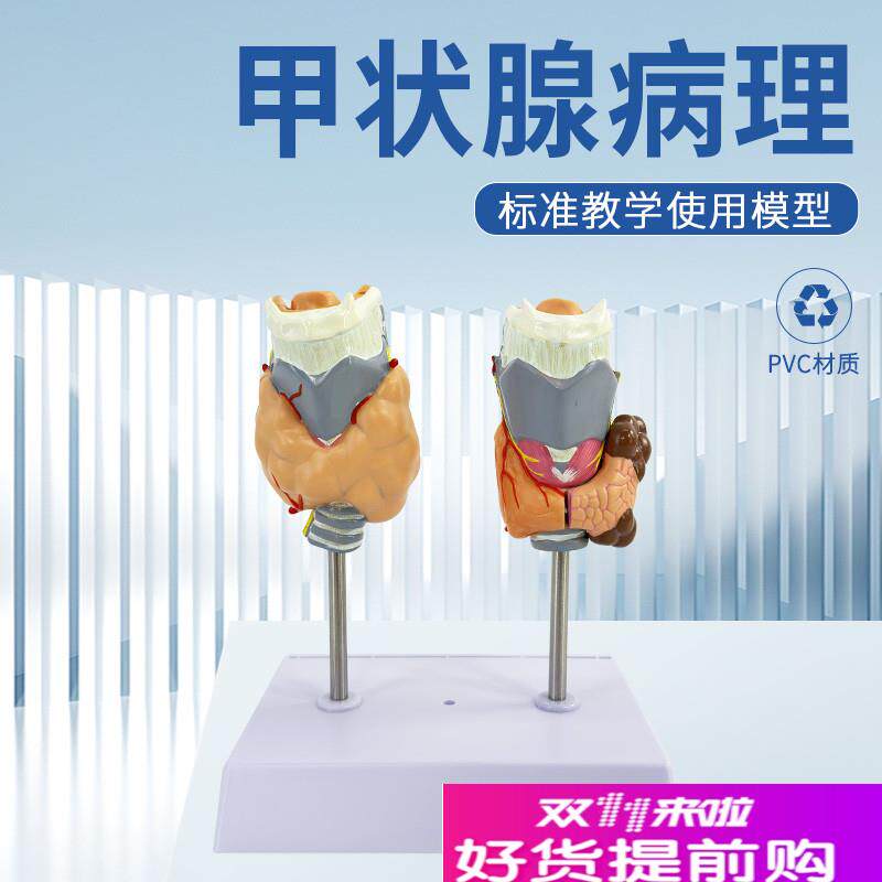 病理甲状腺模型喉头解剖模型甲状腺留M甲状线囊中甲状线病