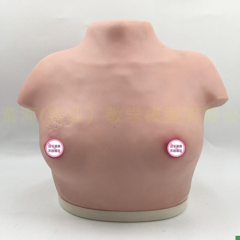 女性乳房乳腺检查模型高级乳y腺视诊与触诊模型医学临床教学模型