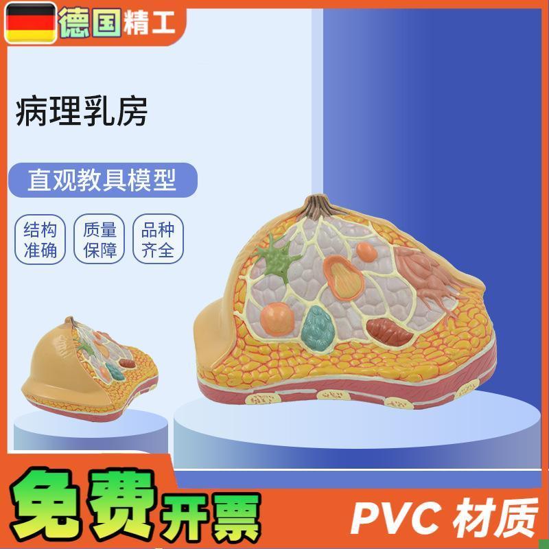 德国】PNT-07l40妇科乳房解剖模型乳房病理解剖乳房结构模型