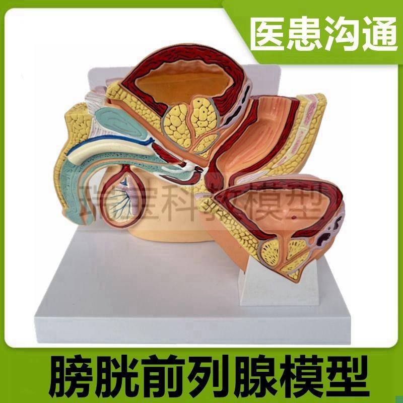 前列腺模型病理增肥尿道狭窄男科医患生殖泌尿Q器官临床教医药礼
