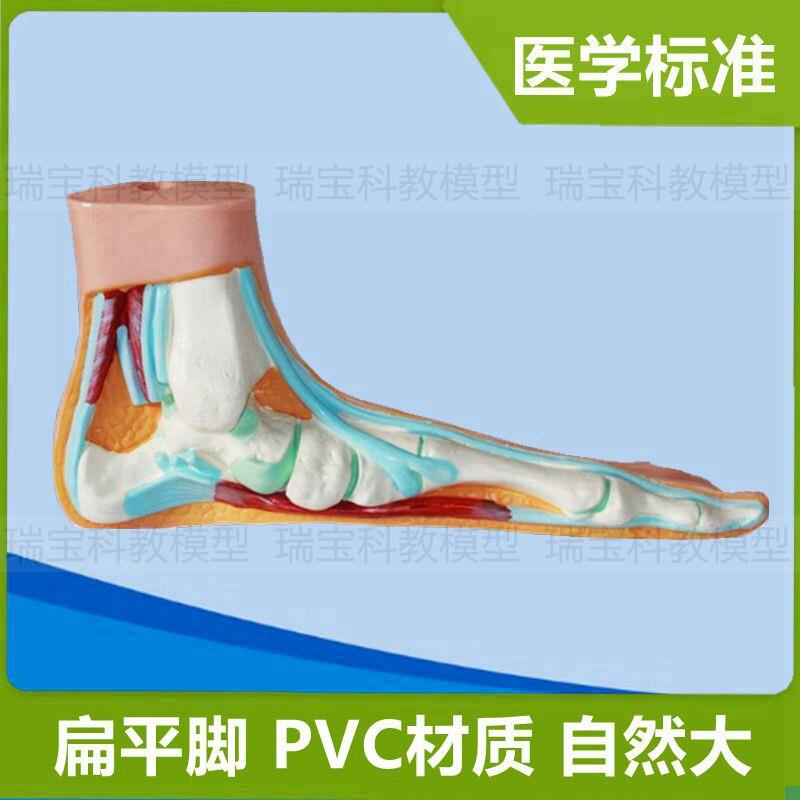 畸形脚模型扁平足弓形骨骼关节活动D人体脚骨仿真1:1比例医用解剖