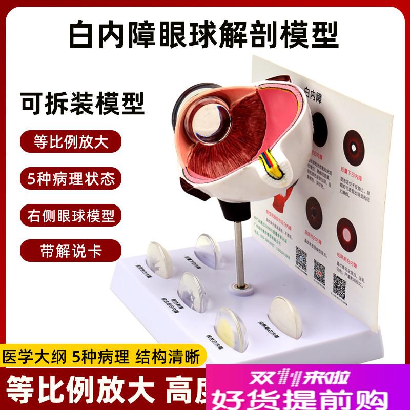 人体仿真眼睛眼球3d结构放大解剖模型白K内障病理演示医学教学道