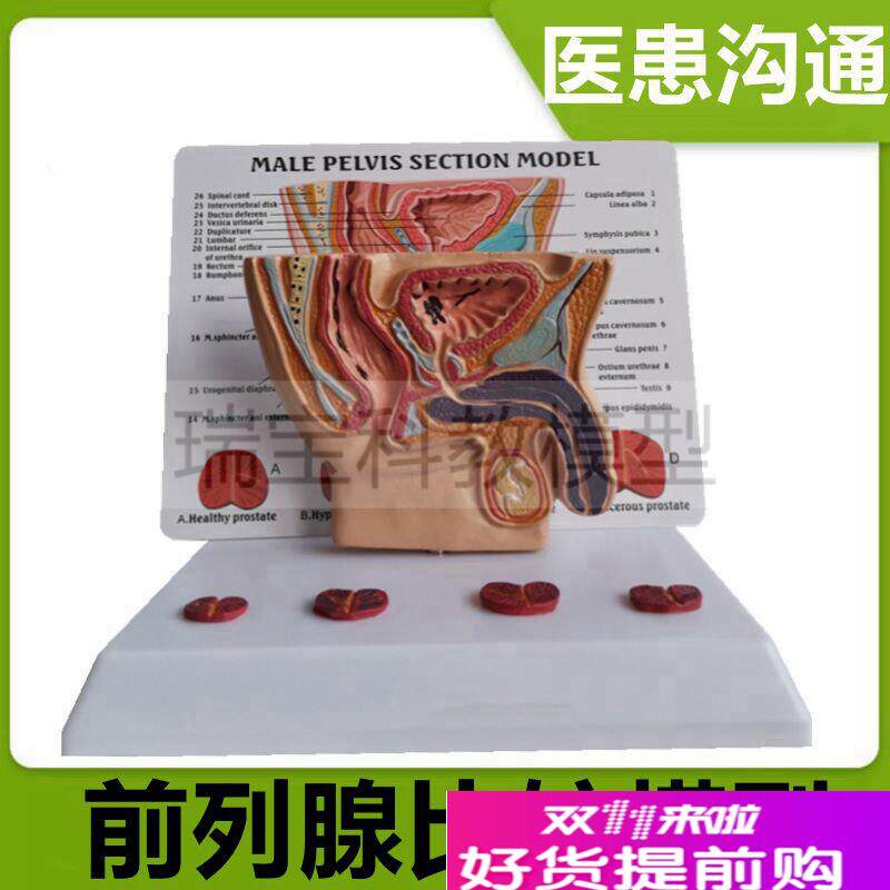 男盆腔模型泌尿生殖器官前列腺膀胱尿道变化狭窄老V年人男科医患